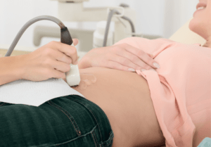 Badanie USG jamy brzusznej — lekarz przykłada głowicę do brzucha pacjentki leżącej na kozetce
