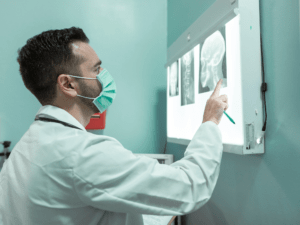 Lekarz analizuje RTG czaszki i kręgosłupa szyjnego na negatoskopie