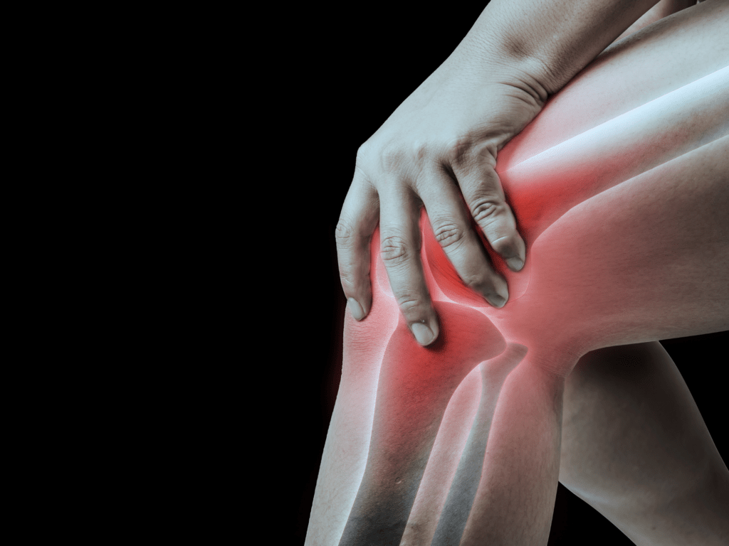 Ból kolana w chorobie zwyrodnieniowej stawu kolanowego – wizualizacja