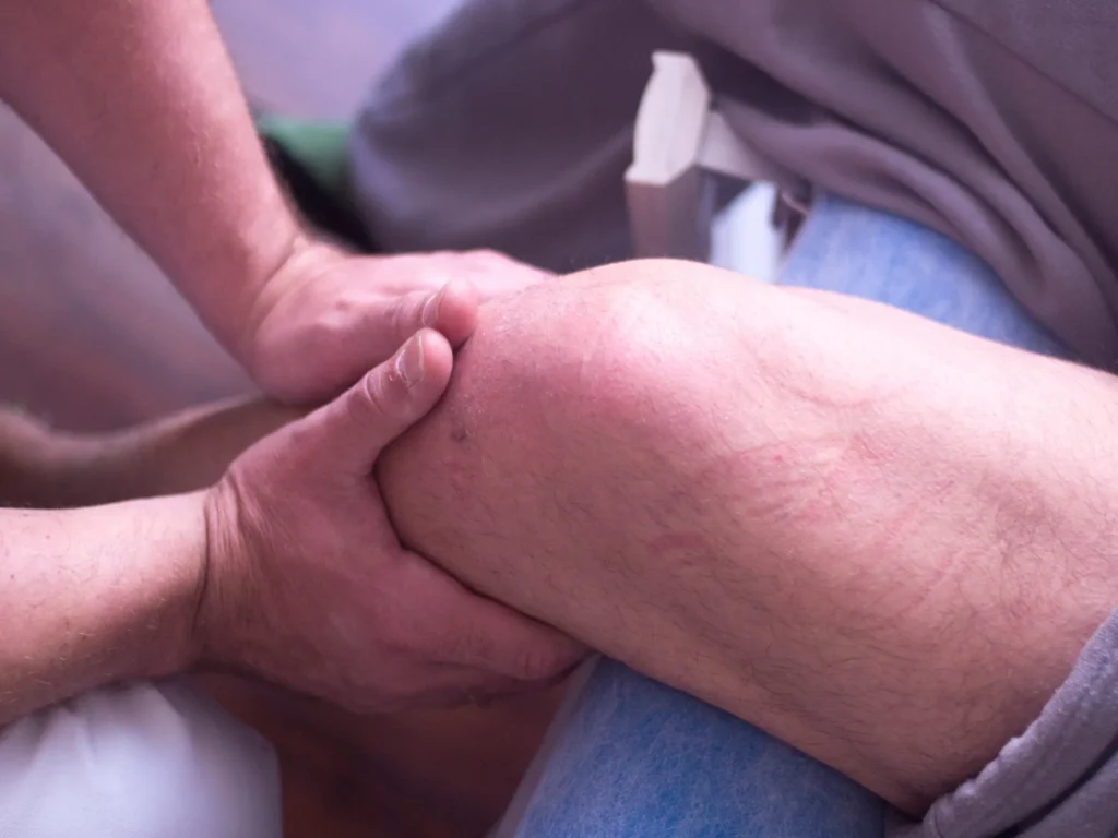 Fizjoterapeuta wykonujący terapię manualną kolana podczas rehabilitacji łąkotki