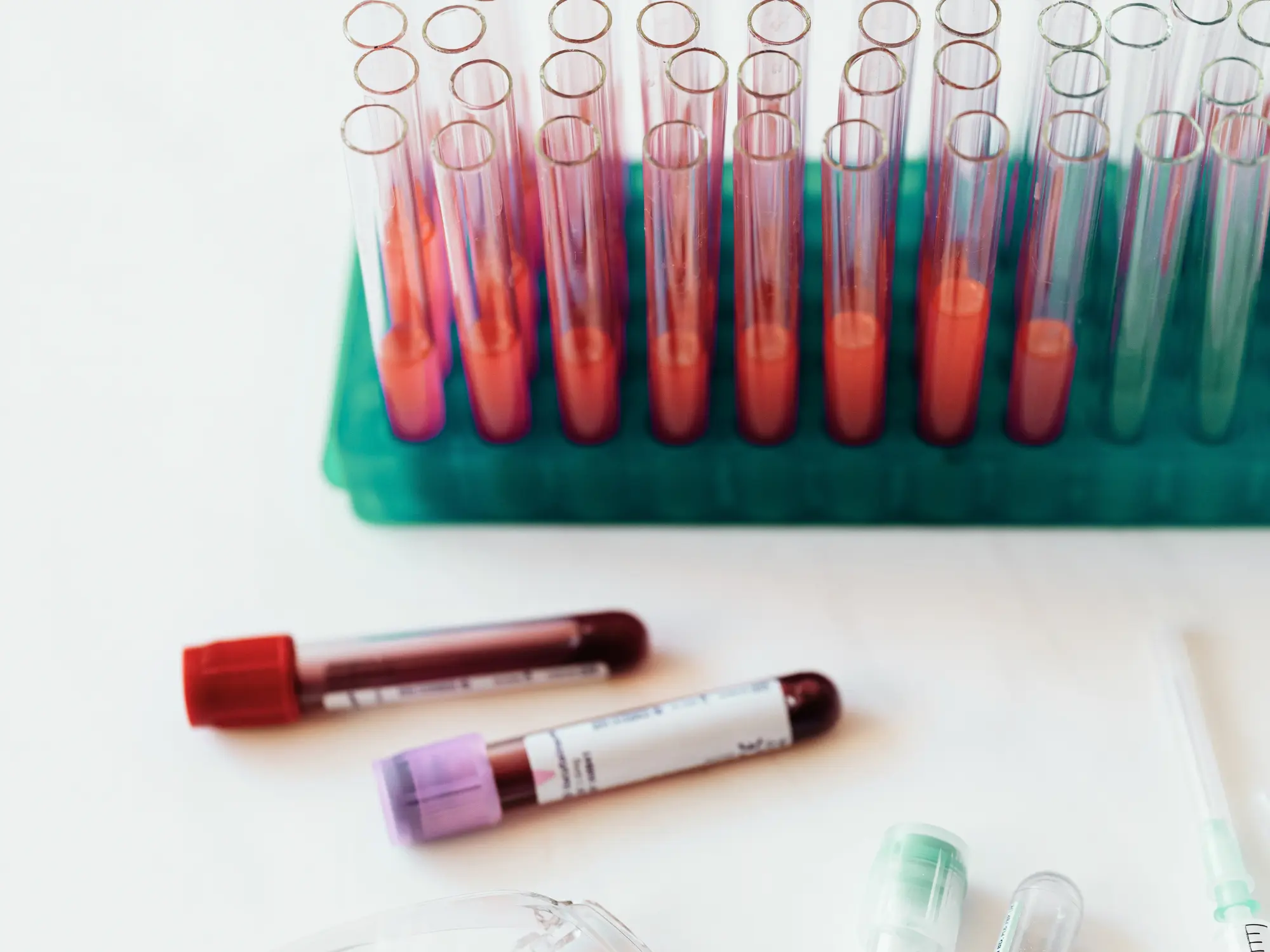 hematolog bada krew dziecka w laboratorium